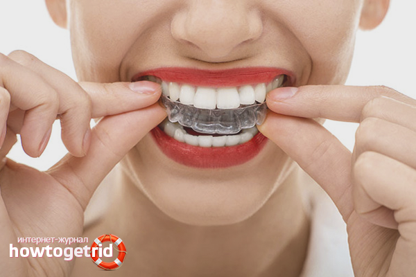 How to change a bite