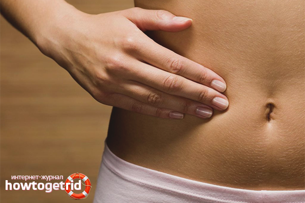 Wie man eine Blinddarmentzündung bestimmt