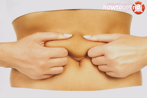 How to tighten the skin on the stomach after childbirth