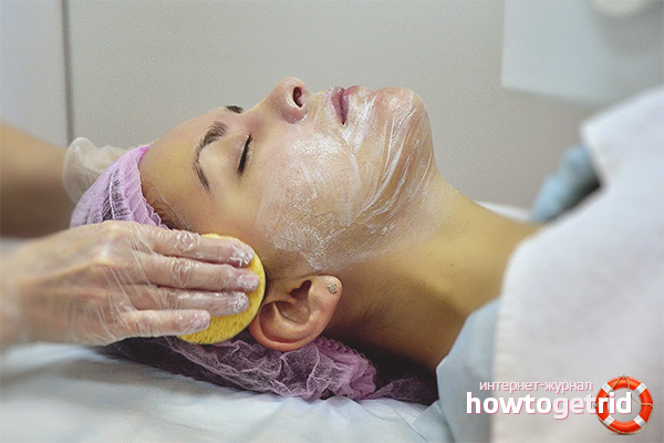 Cosmetic procedures for age spots