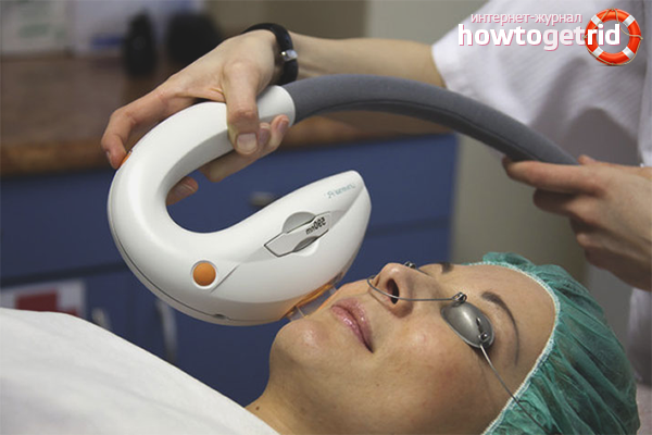 Cosmetic procedures against age spots