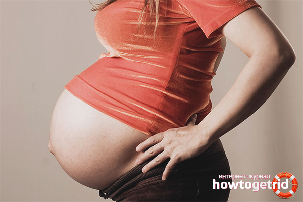 Polyhydramnios during pregnancy