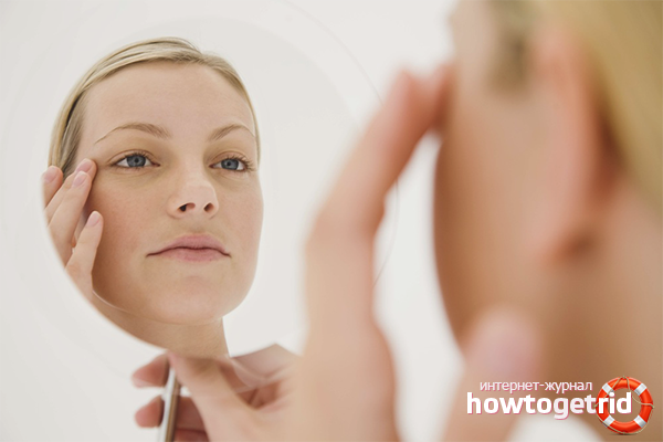 Why does the face and eyes swell in the morning