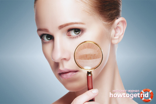 Why do age spots appear on the face?