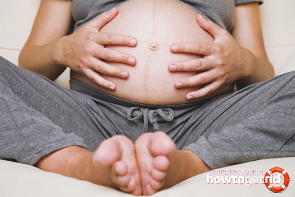 Consequences of polyhydramnios during pregnancy