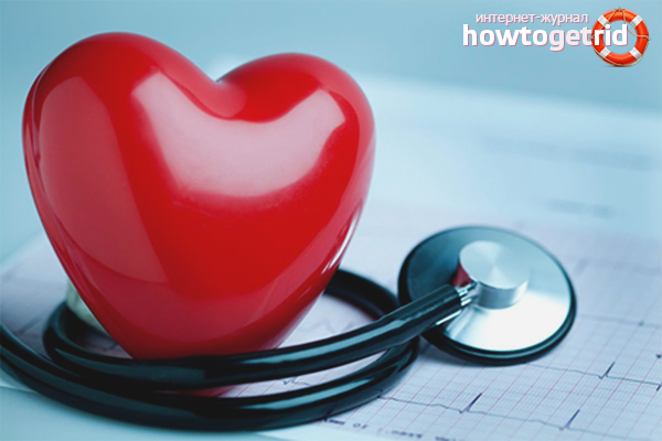 Fibrillation auriculaire