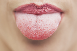 The tip of the tongue hurts