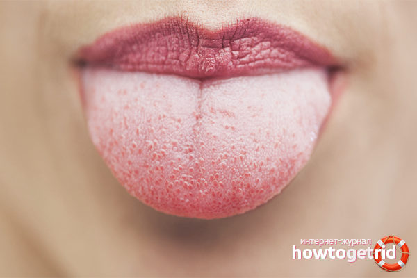 Le bout de la langue fait mal