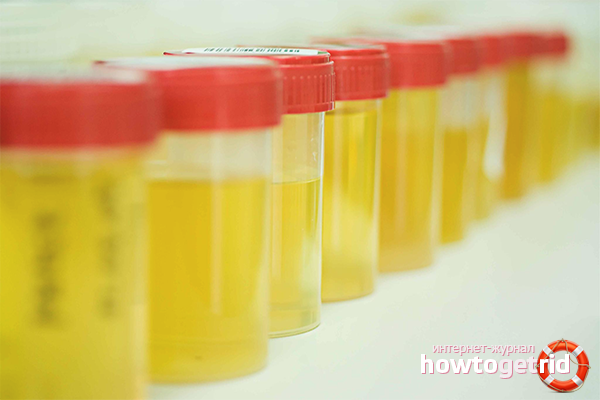 Pathologische Ursachen für erhöhte Acetonspiegel im Körper