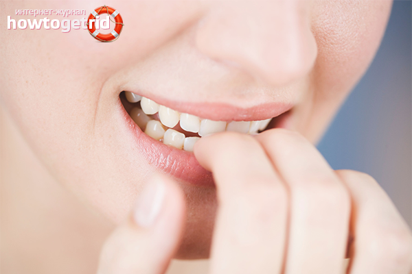 Comment se débarrasser de l'habitude de se ronger les ongles