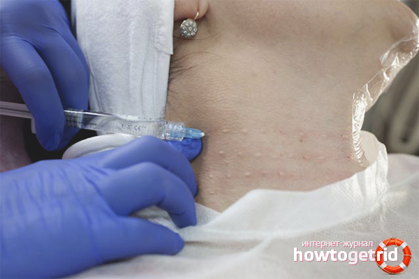 Services professionnels de Venus anneaux sur le cou