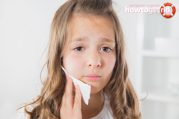 What to do if a child has a toothache