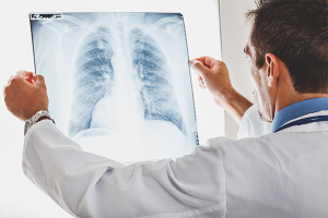 How to identify pneumonia
