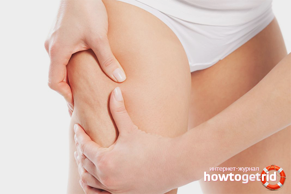 Comment éliminer la cellulite du pied