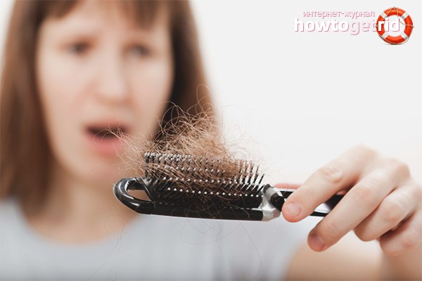 Hair loss in women