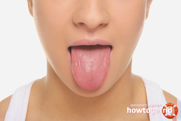 Wie man Zungenschmerzen behandelt