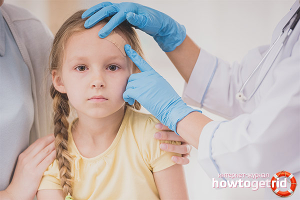 Diagnose einer Gehirnerschütterung bei Kindern