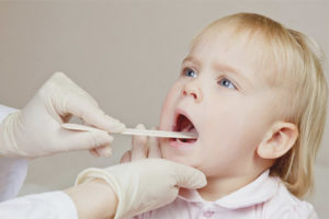 Herpes sore throat in children
