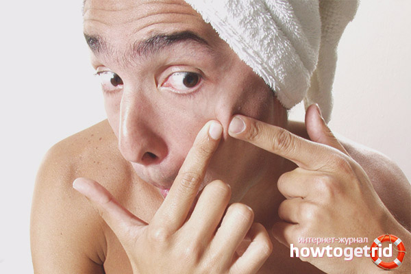 How to draw pus from an acne