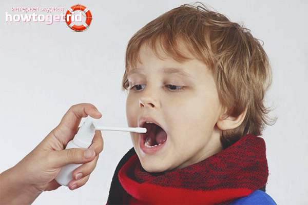 Treatment of herpes sore throat in children
