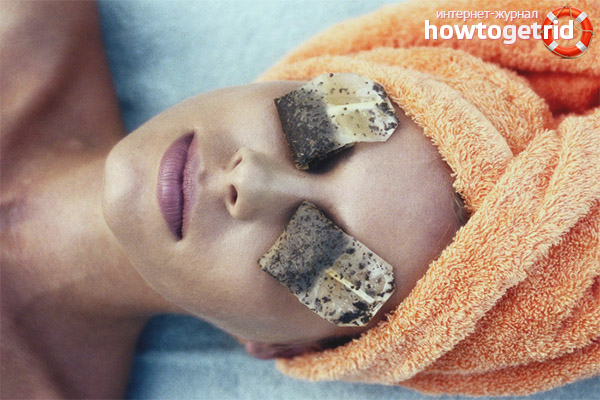 Folk remedies for edema under the eyes