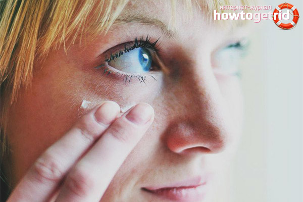 Swelling under the eyes