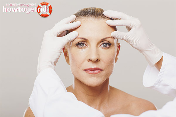 Treatment of facial swelling