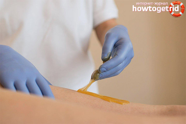 Is it possible to do shugaring during pregnancy