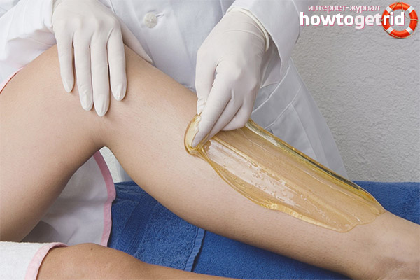 Contraindications for shugaring during pregnancy