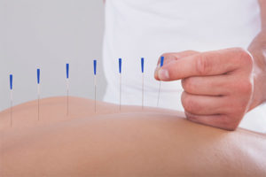 The benefits and harms of acupuncture