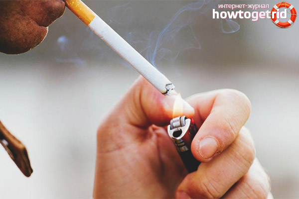 Why not smoke after gallbladder removal