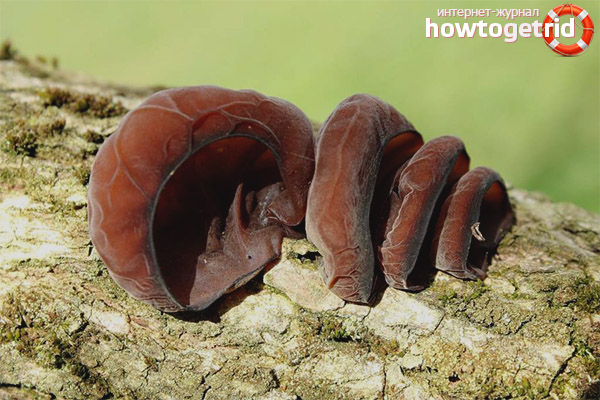 The use of auricularis auricularis in medicine